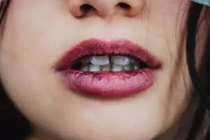为什么有些人喝完红酒嘴唇和舌头变黑？