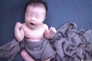 20天宝宝“拍照”后发烧，医生下病危通知书：为留念差点害了孩子