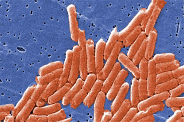 美沙门氏菌来袭，已致43州640人感染，加拿大也被波及