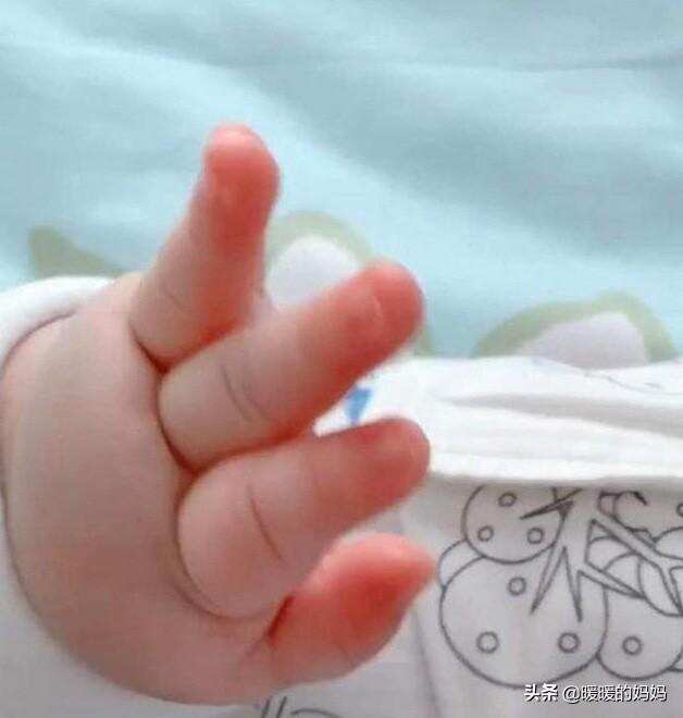 宝妈吐槽宝宝小手像“猪蹄”，看完照片，网友：母乳里加酵母了？
