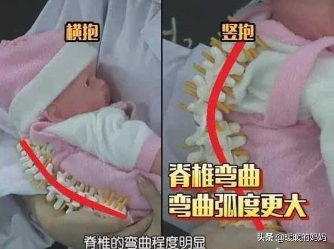 3个月宝宝“脊柱”发育弯曲，爸爸后悔不已，父母别对娃做这3件事