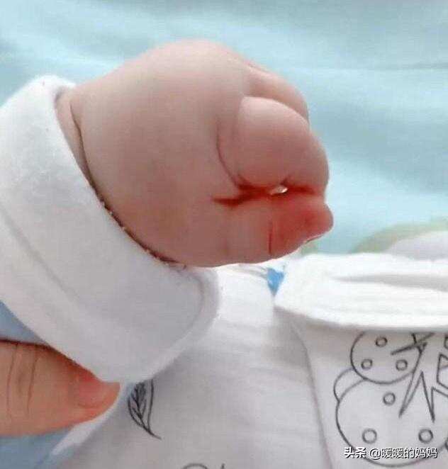 宝妈吐槽宝宝小手像“猪蹄”，看完照片，网友：母乳里加酵母了？