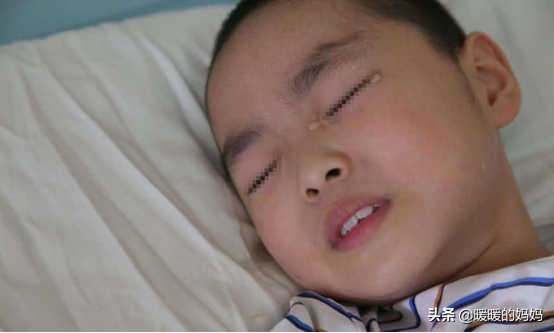 9岁男孩腹痛3天，医生手术取出多种“异物”，网友惊愕：不能直视